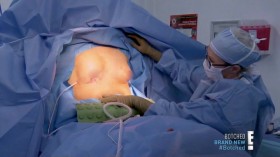 Botched S05E10 Playing With Fire HDTV x264-CRiMSON EZTV