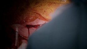 Surgeons At the Edge of Life S05E01 1080p HDTV H264-DARKFLiX EZTV