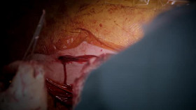 Surgeons At the Edge of Life S05E01 XviD-AFG EZTV