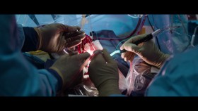 The Surgeons Cut S01E02 1080p HEVC x265-MeGusta EZTV