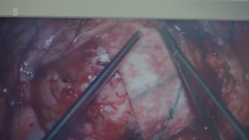 999 Critical Condition S04E03 XviD-AFG EZTV
