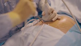 Baby Surgeons Delivering Miracles S01E02 XviD-AFG EZTV