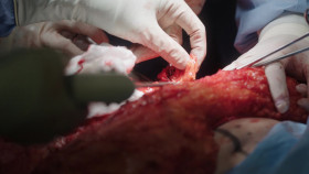 Botched Bariatrics S01E02 1080p WEB h264-FREQUENCY EZTV