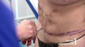 Botched S06E22 Witchy Whips and Super High Nips HDTV x264-CRiMSON EZTV