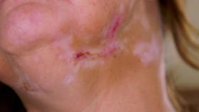 Dr Pimple Popper 2018 S04E06 1080p AMZN WEB-DL H265 SDR DDP 2 0 English-HONE EZTV