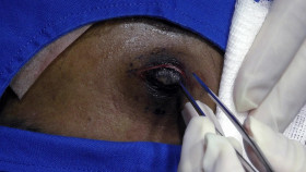 Dr  Pimple Popper 2018 S05E04 1080p AMZN WEB-DL H265 SDR DDP 2 0 English-HONE EZTV