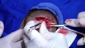 Dr  Pimple Popper 2018 S05E05 1080p AMZN WEB-DL H265 SDR DDP 2 0 English-HONE EZTV