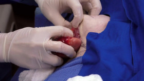 Dr  Pimple Popper 2018 S05E06 1080p AMZN WEB-DL H265 SDR DDP 2 0 English-HONE EZTV