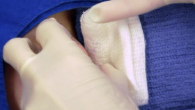 Dr  Pimple Popper 2018 S05E10 1080p AMZN WEB-DL H265 SDR DDP 2 0 English-HONE EZTV