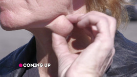 Dr  Pimple Popper 2018 S08E05 1080p AMZN WEB-DL H265 SDR DDP 2 0 English-HONE EZTV