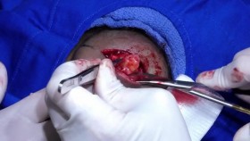 Dr Pimple Popper S05E05 Pain in the Neck WEB h264-CAFFEiNE EZTV