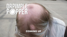 Dr Pimple Popper S09E20 1080p HEVC x265-MeGusta EZTV