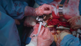 Greys Anatomy S21E06 XviD-AFG EZTV