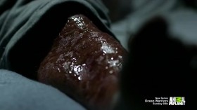 Monsters Inside Me Extra Deadly S01E08 HDTV x264-CRiMSON EZTV