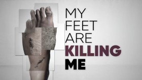 My Feet Are Killing Me S02E01 Hornets Nest Feet 720p HEVC x265-MeGusta EZTV