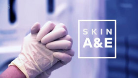 Skin A and E S04E11 XviD-AFG EZTV