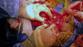 Super Surgeons A Chance at Life S02E02 1080p HEVC x265-MeGusta EZTV