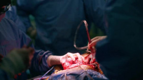 Super Surgeons A Chance at Life S02E02 XviD-AFG EZTV