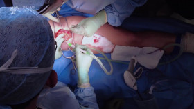 Super Surgeons A Chance at Life S02E03 1080p HDTV H264-DARKFLiX EZTV