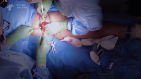 Super Surgeons A Chance at Life S02E03 1080p HEVC x265-MeGusta EZTV