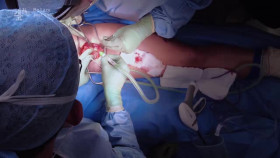 Super Surgeons A Chance at Life S02E03 XviD-AFG EZTV