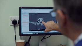 Surgeons A Matter of Life or Death S02E02 720p MY5 WEB-DL AAC2 0 H 264-RAWR EZTV