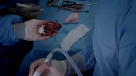 Surgeons At the Edge of Life S04E03 1080p HEVC x265-MeGusta EZTV