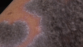 The Bad Skin Clinic S07E09 The Pain Was Off the Scale 1080p AMZN WEB-DL DDP2 0 H 264-RAWR EZTV