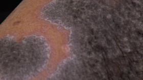 The Bad Skin Clinic S07E09 The Pain Was Off the Scale 720p AMZN WEB-DL DDP2 0 H 264-RAWR EZTV