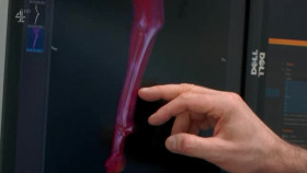 The Supervet Noel Fitzpatrick S17E02 XviD-AFG EZTV