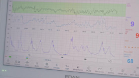 The Young Midwives of Essex S01E08 1080p WEB h264-CODSWALLOP EZTV