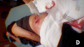 This Came Out of Me S01E01 Swollen Infected Impaled XviD-AFG EZTV