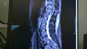 Trauma Room One S01E05 1080p HDTV H264-DARKFLiX EZTV