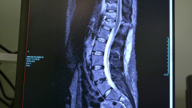 Trauma Room One S01E05 1080p WEB H264-CBFM EZTV